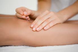 IMS, Dry Needling